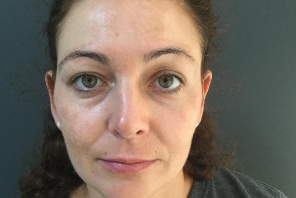 Antes de un peeling facial 
