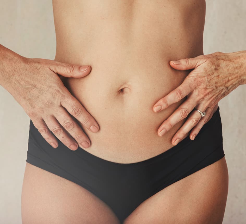 qué es safe lipo